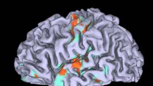 Scoperto nel cervello il motore dell'effetto placebo