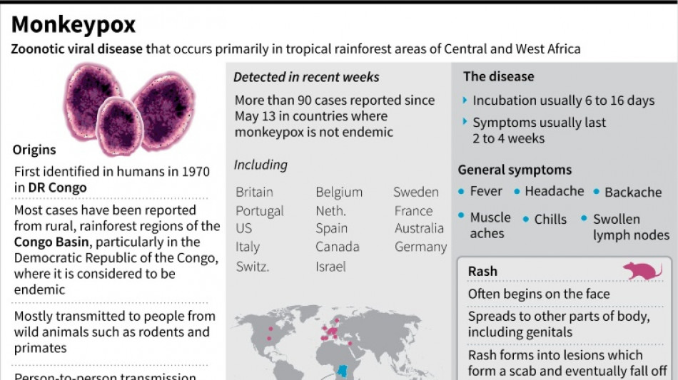 Monkeypox can be stopped outside endemic countries: WHO