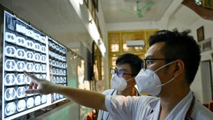 Asia-Pacific gets new weapon in fight against drug-resistant TB