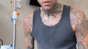 Fedez dimesso dal Policlinico, selfie dall'ascensore